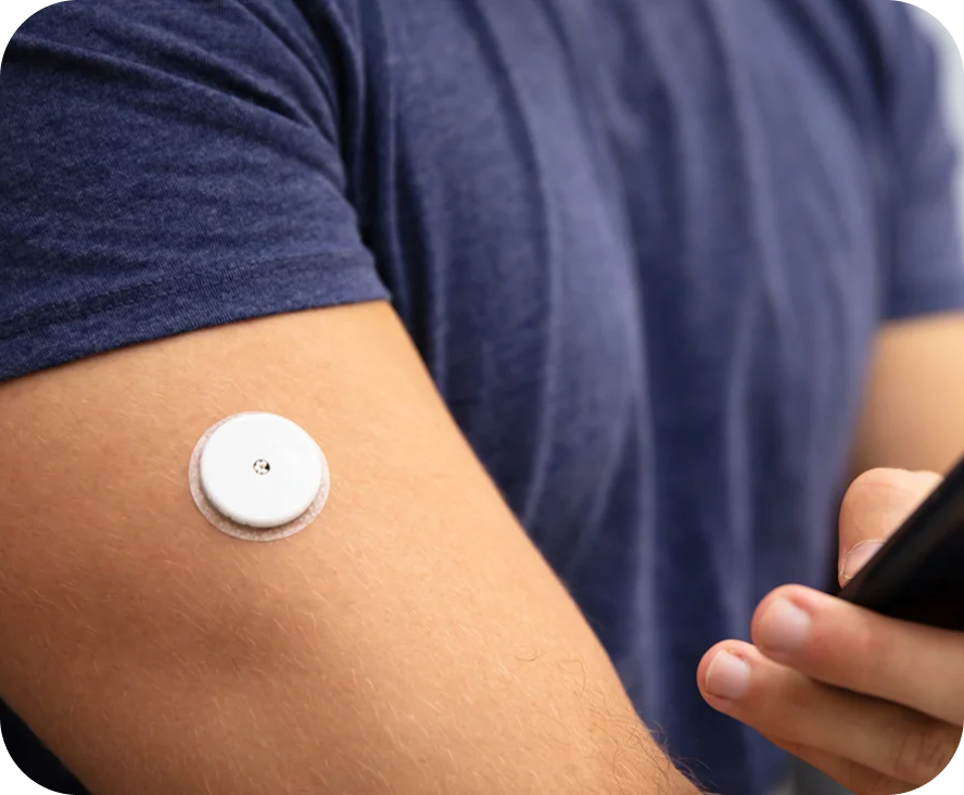 A closeup of a person's arm with a white medical device patch on their bicep.